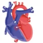 Ventricular Septal Defect_edited.png 85x85